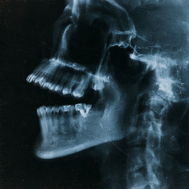 X-ray style, Midjourney V8.2, render 4 of 4