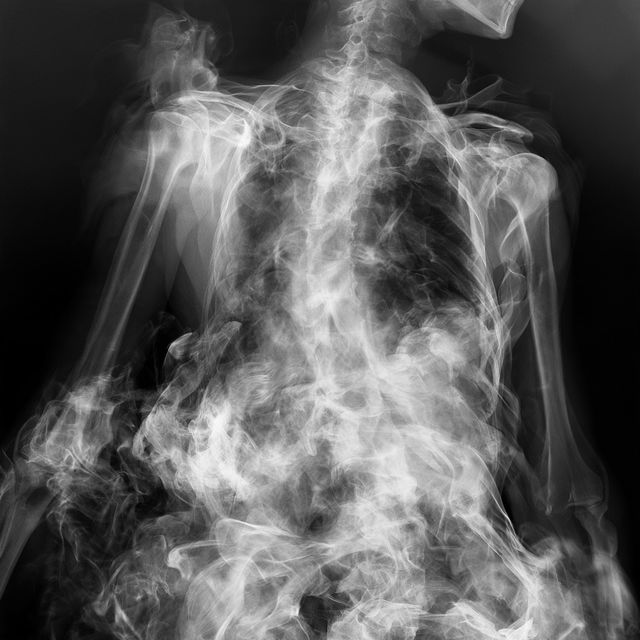 X-ray style, Midjourney V8.2, render 3 of 4